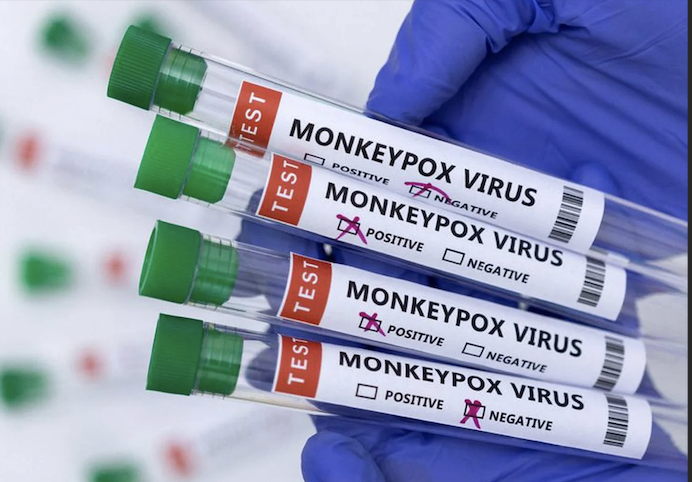 monkeypoxvirus