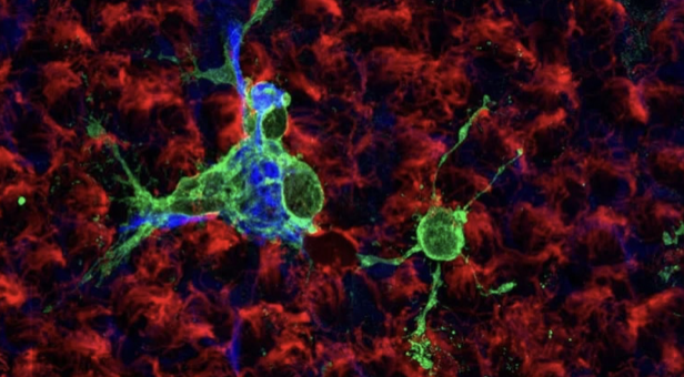 De qué forma el COVID infecta a las células claves del cerebro según un estudio