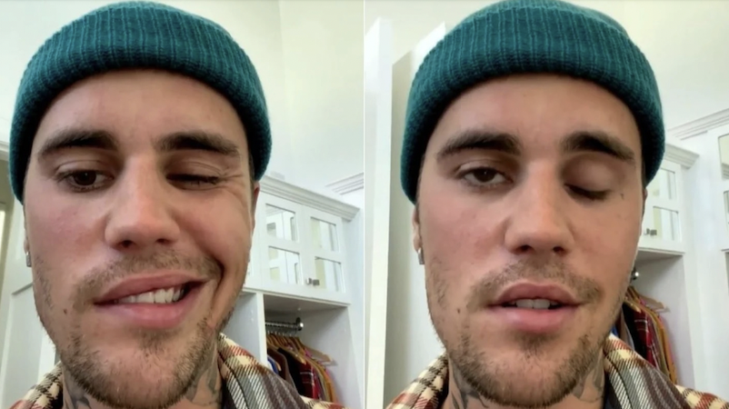 JUSTIN B