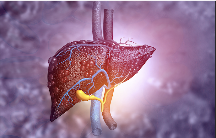 hepatitisaguda