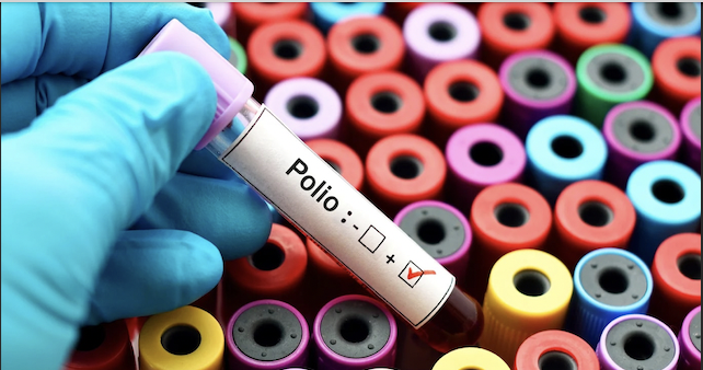 polio