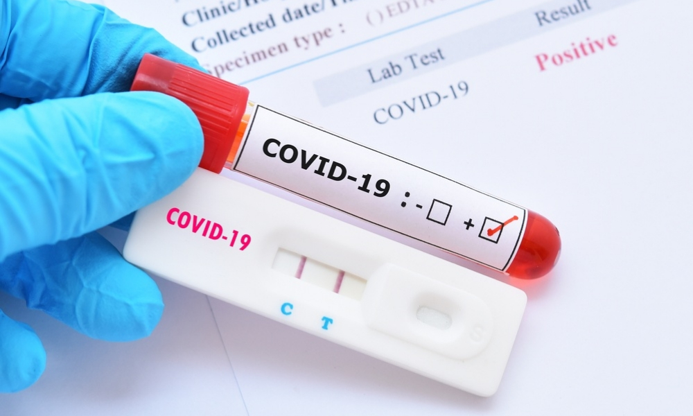 precios pruebas coronavirus mx gr